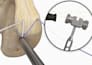 create 3d medical device animation, surgical procedure and orthopedic animation